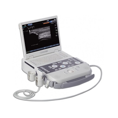 Ультразвуковой сканер Acuson P300